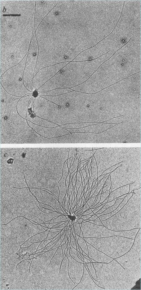 Centrosomen Mikrotubuli bilden sich an isolierten Centrosomen aus Ultradünnschnitt von