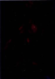 Spezifische Fluoreszenz im Zytoplasma der Zellen im rechten Bild.