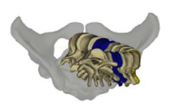 Wertvolle 3D-Information Visualisierung der Patienten Anatomie in