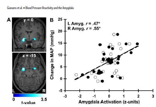 Amygdala Aktivierung korreliert