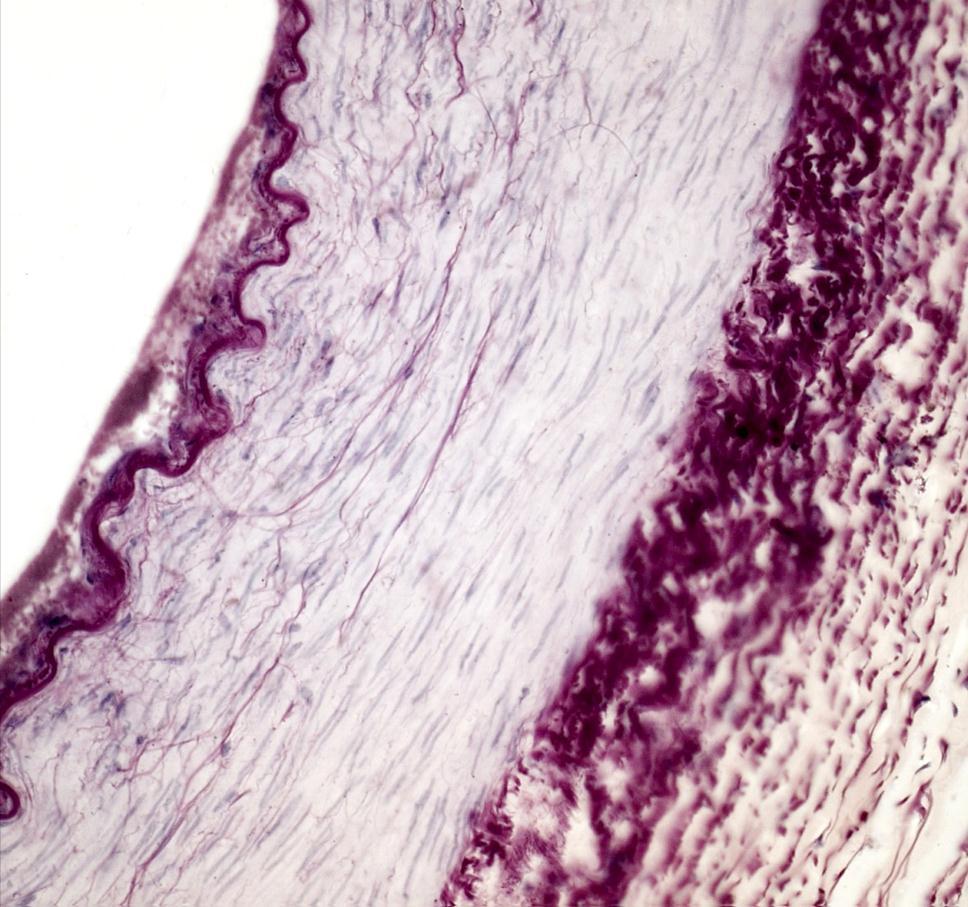 Arterie vom muskulären Typ (links) und Vene (rechts) (Elastika,