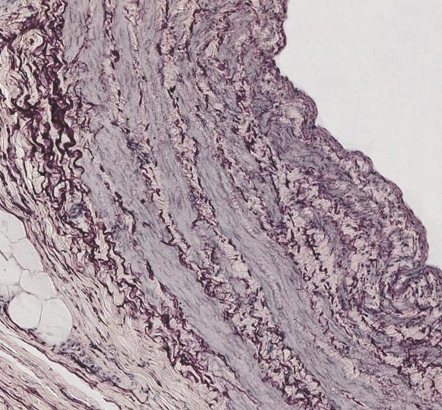 Membrana elastica interna 4 glatte Muskulatur der Tunica media (in der