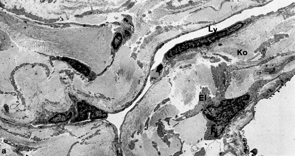 Lymphgefäß, EM Fi Lymphgefäß (Ly) in der Wand eines Bronchiolus, Mensch.