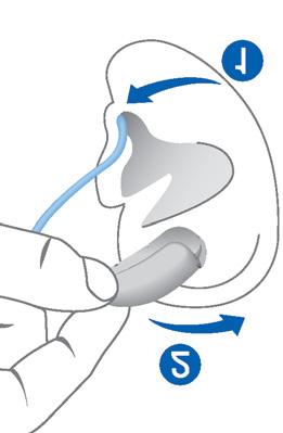Hörsystem einsetzen: X Halten Sie den Schlauch nahe am Ohrstück. X Schieben Sie das Ohrstück vorsichtig in den Gehörgang ➊. X Drehen Sie es leicht, bis es gut sitzt.
