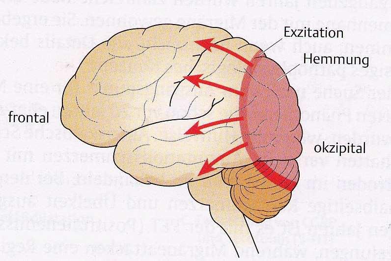 Pathophysiologie der Aura Cortical Spreading