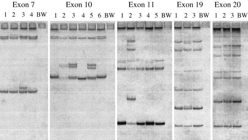 Zystische Fibrose Abb. 3 Silbergefärbtes Polyacrylamidgel mit PCR-Produkten von Exon 7, 10, 11, 19 und 20 des CF- Gens.