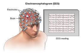 Stellenwert EEG?