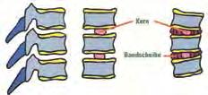 Zwischen den einzelnen Wirbeln liegen knorpelige Zwischenwirbelscheiben (Bandscheiben), die aus einem zwiebelschalenförmig aufgebauten Ring aus Faserknorpeln und einem gallertartigen, wasserreichen