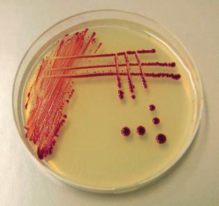 5 x10 30 Mikrobenzellen auf der Erde William Whitman (Athens, Georgia, USA), schätzt die Zahl der Archaeen und der Bakterien auf unserem Planeten auf 5 x 10 30 Zellen.