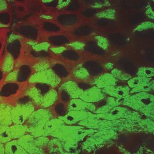 25 Jahre VAAM Blochmannia-haltige Bacteriocyten (grün) zwischen normalen Darmzellen (rötlich mit großem Kern) von Ameisenlarven. Konfokale Laserscanning-Mikroskopie. Foto: Sascha Stoll, Würzburg.