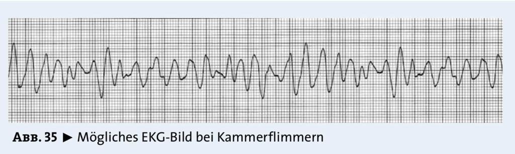 Hyperdynamer