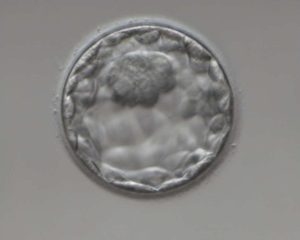 Kryokonservierung Eizellen (MII) unbefruchtet Vitrifizierung Eizellen befruchtet (2PN) slow freezing Blastozysten (Embryos) Indikation Keine Spermien am Tag IVF ICSI