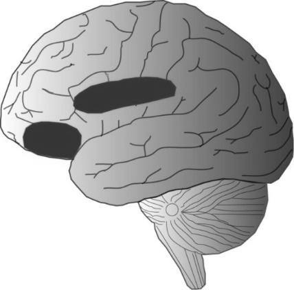 fissure Belohnungsareale: Amygdala Nucleus Accumbens Orbitofrontal Cortex Ventral Pallidum Ventral Tegmental Area Assoziierte Areale involviert in Motivation: Anterior