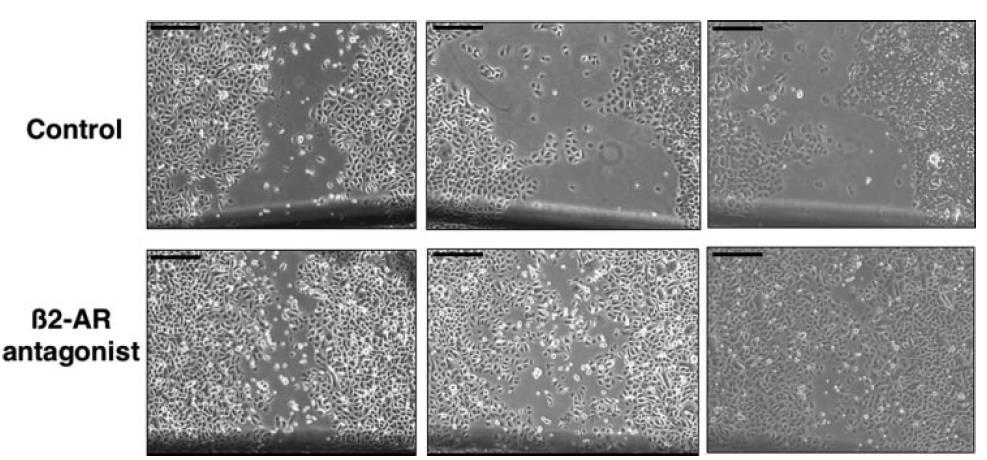 β2-ar Antagonisten beschleunigen die Heilung von Kratzwunden in Keratinozyten- Kulturen. Keratinozyten wurden gezüchtet, um auf Kollagen beschichteten Kunststoffschalen zu konfluieren.