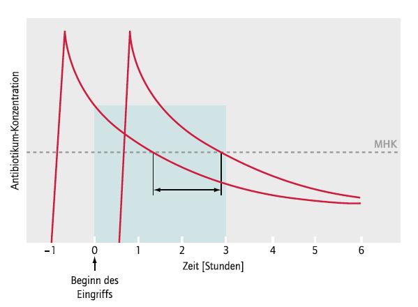 Abb. 1: Effektive Periode der perioperativen Antibiotikaprophylaxe MHK= Minimale Hemmkonzentration ist die kleinste Wirkstoffkonzentration einer antimikrobiellen Substanz (z. B.