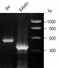 3 33B3B BErgebnisse 3B Abb. 3.37 Supervillin wird in primären humanen Makrophagen exprimiert.