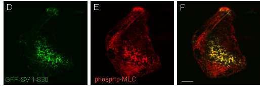 3 33B3B BErgebnisse 3B Abb. 3.46 Phosphoryliertes Myosin lokalisiert an Supervillin-Kabeln.