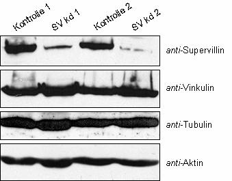 3 33B3B BErgebnisse 3B Abb. 3.50 Knock-down von endogenem Supervillin. Reduktion von endogenem Supervillin in HeLa Zellen mittels RNAi.