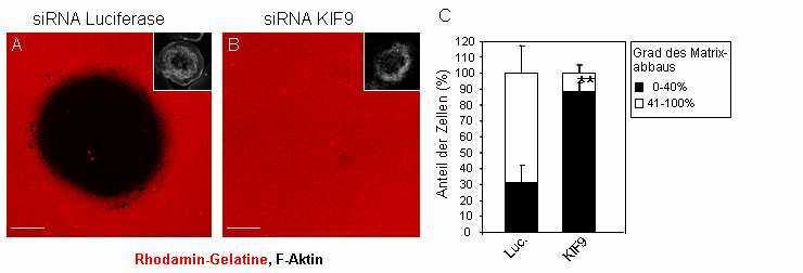 3 33B3B BErgebnisse 3B 3.3.7 87BEinfluss von KIF9 auf den Abbau extrazellulärer Matrix Wie bereits in 3.3.1 durch knock-down-versuche gezeigt wurde, ist KIF9 an der Regulation der Podosomen in primären humanen Makrophagen beteiligt.