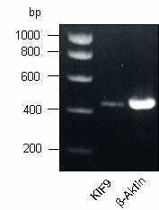 3 33B3B BErgebnisse 3B Abb. 3.27 KIF9 wird in primären humanen Makrophagen exprimiert.