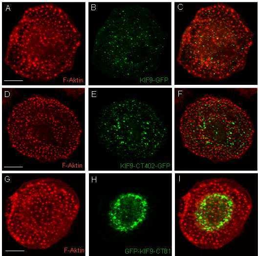3 33B3B BErgebnisse 3B Abb. 3.30 Immunfluoreszenzaufnahmen, die die Expression unterschiedlicher KIF9-GFP Konstrukte in primären humanen Makrophagen zeigen.