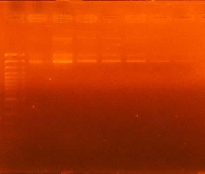 Bsp. I Plasmid-DNA Mini-Prep (14) Photometrische Bestimmung der DNA Konzentration bei 260 nm. Zu 58 µl Waser werden 2 µl der gelösten DNA pipettiert.
