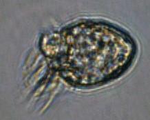 5. Einzellige Organismen im Wassertropfen Wimpertierchen (Ciliophora)1 Bauplanmerkmale: Wimpern
