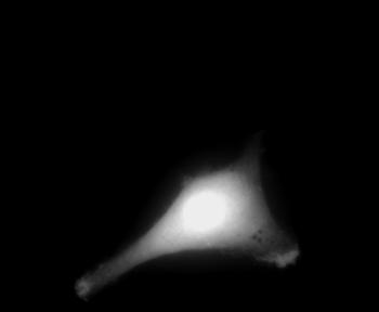 fluoreszenzmikroskopische Aufnahmen von