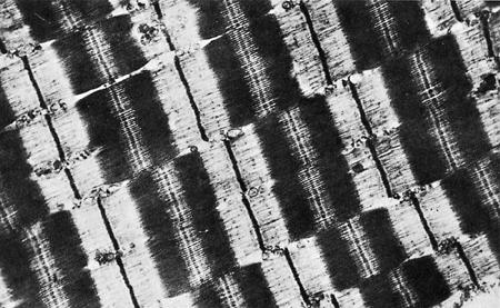 50 µm) unter einem Phasenkontrast- Lichtmikroskop. Man erkennt die dunklen A-Banden und die hellen I-Banden (aus Stryer, 1975).