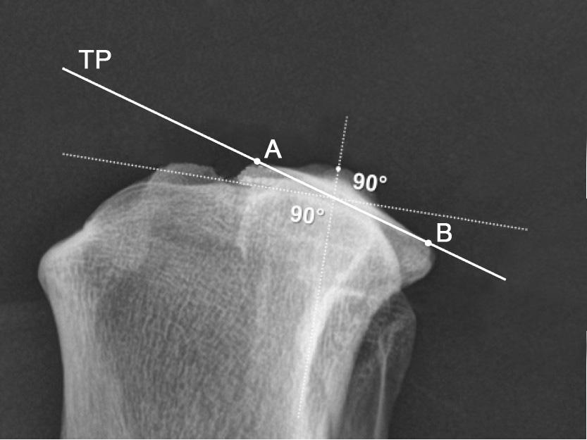 Dabei hat eine Verschiebung des Zentralstrahls bis zu 10 cm distal oder proximal des Kniegelenks ohne Abweichung nach kranial oder kaudal keinen signifikanten Einfluss auf die gemessenen Werte (REIF