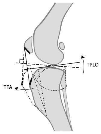 Operationsmethoden Vorverlagern der Tuberositas tibiae bis zu einem Punkt, an dem die Patellarsehne bei vollständiger Streckung des Kniegelenks senkrecht zum Tibiaplateau steht, wird also verhindert,