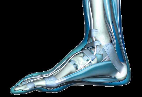 Leichter Senk-Spreizfuß Beim leichten Senk-Spreizfuß leiden Betroffene häufig an einer vorzeitigen muskulären Ermüdung und einem leichten Überlastungsgefühl sowie brennenden Fußsohlen, Knie- und