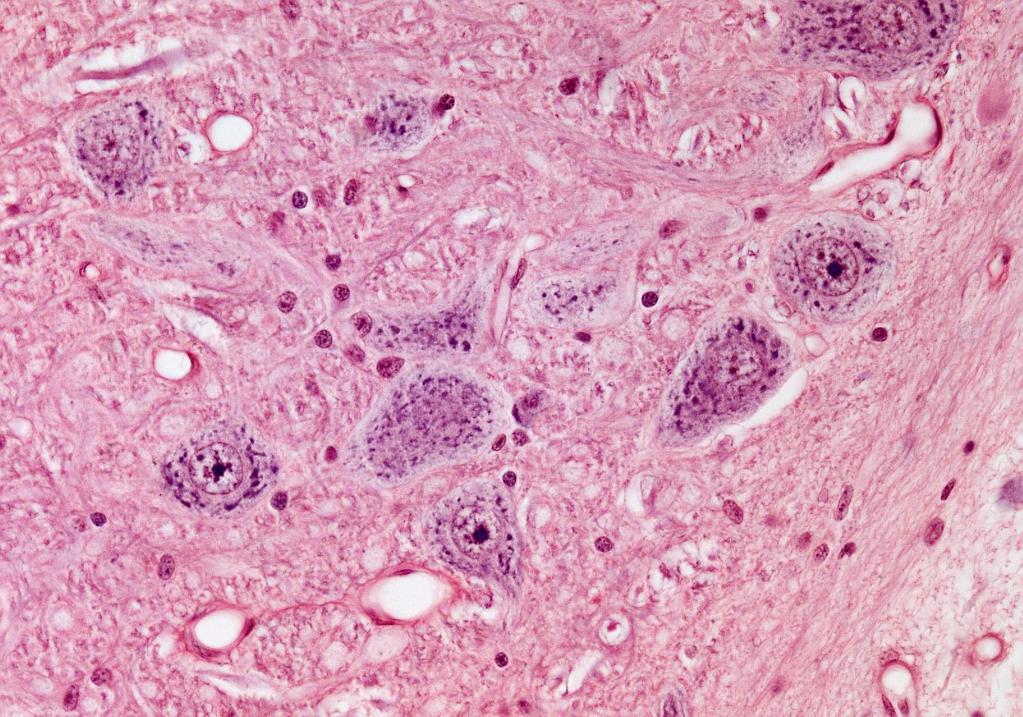 Endoplasmatisches Retikulum: Nissl-Substanz im Perikaryon motorischer Vorderhornzellen Rückenmark (HE) 3