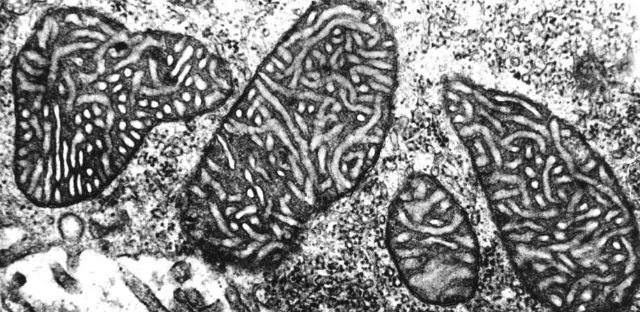 Mitochondrien vom Tubulustyp