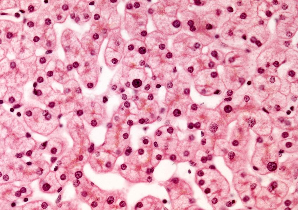Zellkern: Unterschiedliche Kerngröße in Hepatozyten, Zweikernigkeit, Leber (HE) 4 3 3 kleiner
