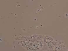 Eigenbewegung, deshalb können sie mit Rundepithelien oder Leukozyten verwechselt werden amorphe Salze - kleine, lichtbrechende Festkörper - in Haufen (auf Zellen) oder verteilt - keine diagnostische