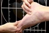 Von experten empfohlen Vier punkte auf die es ankommt 1. Die Fußanalyse Misst die Druckbelastung Ihres Fußes im Schuh.