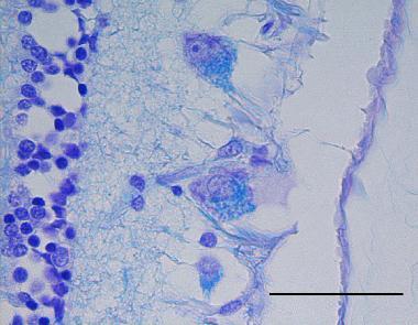 Abbildung 1 Darstellung des Ceroid-Lipofuszin in der Retina (Netzhaut) bei einem an NCL erkrankten Tibet Terrier.