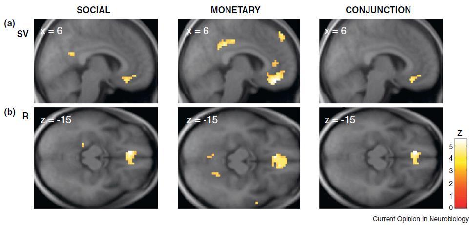 Aktivierung im ventromedialen Präfrontalkortex in Reaktion auf soziale und monetäre Werte Bilder lächelnder vs.