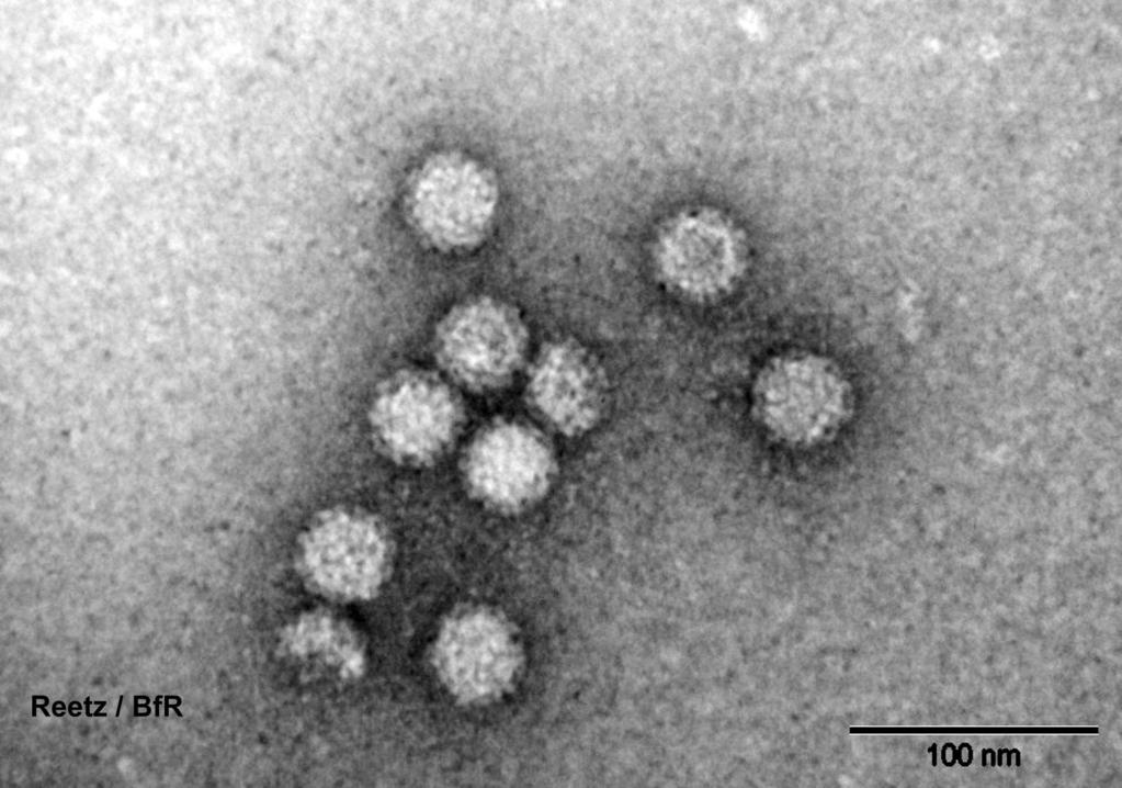 Virusnachweis in Lebensmitteln Noroviren im Elektronenmikroskop Reetz, BfR Probleme: - Vielfalt der Lebensmittel - Viren sind