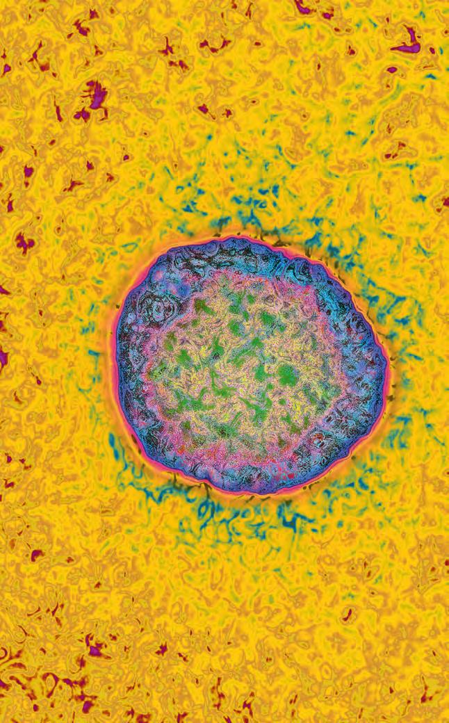 Hepatitis C-Virus: Mit nur wenigen eigenen Genen bringt es eine infizierte Zelle unter seine Kontrolle. ses Enzym lahmlegt, kommt die Virusvermehrung zum Erliegen.