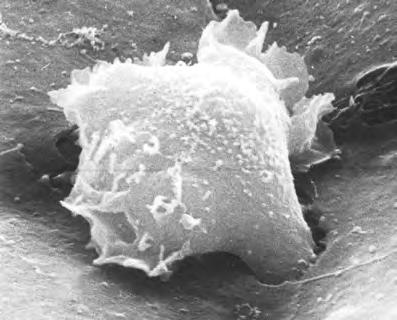Krebszellen programmieren Blutgefäße um Um sich über die Blutbahn im Körper auszubreiten, müssen Krebszellen die Gefäßwand passieren. Dazu nutzen sie einen Trick.