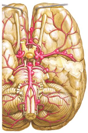 Kongenitale intrakranielle Aneurysmen Anatomie auf S. 573 Verteilung intrakranieller Aneurysmen A. cerebri anterior (30%) distaler Abschnitt der A. cerebri anterior (5 %) A.