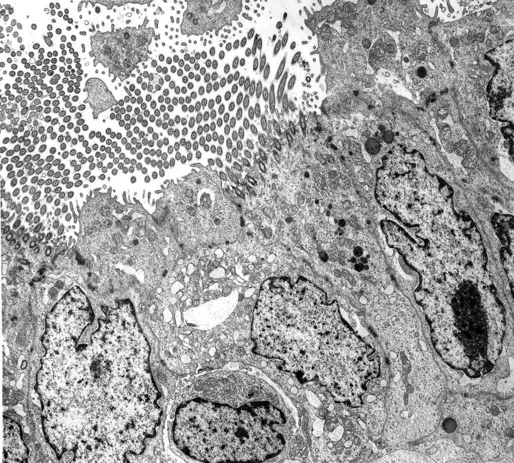 3.2.1 Untergruppe 1 Die Lamina epithelialis dieser drei Tuben setzt sich aus hochprismatischen flimmernden und flimmerlosen sekretorischen Zellen zusammen.