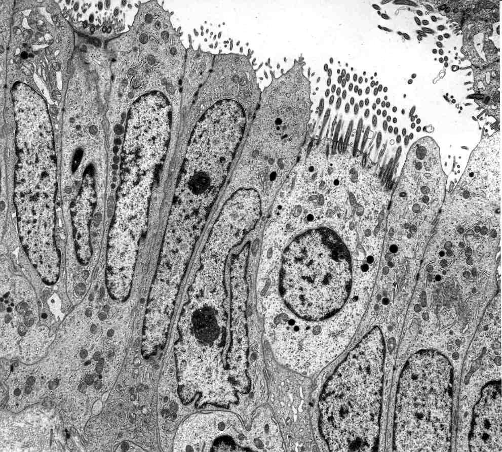 meist an der konkaven Seite aufhalten. Der größte Teil der Mitochondrien kommt supranukleär vor, einige sind auch peri- oder infranukleär zu finden. Sie gehören zum Crista-Typ.