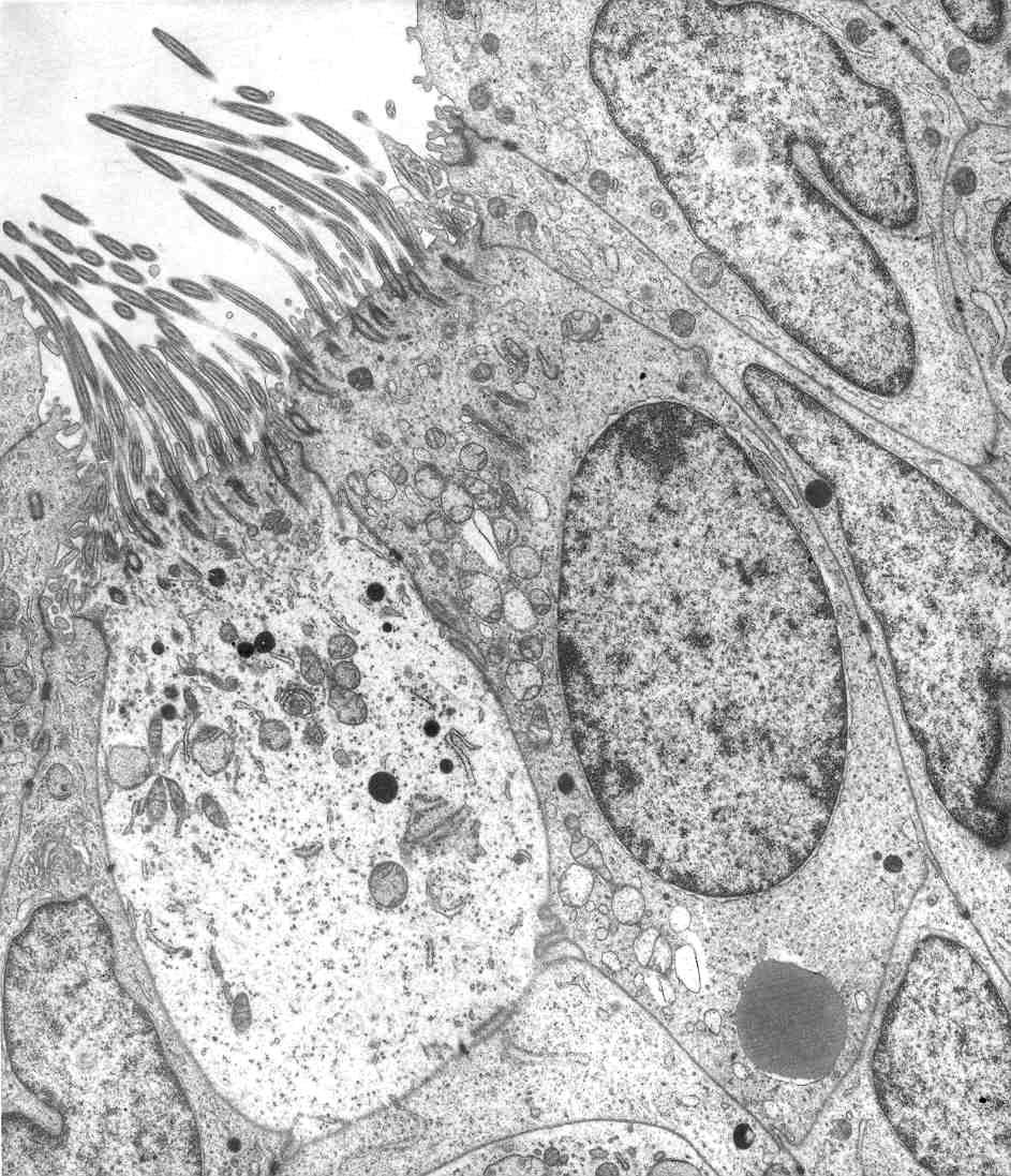 Zellmembran nebeneinander auf. Auch diese Zellen weisen den für Flimmerzellen typischen Organellenbesatz auf. Flimmerbildung konnte in den beiden Tuben nicht beobachtet werden.