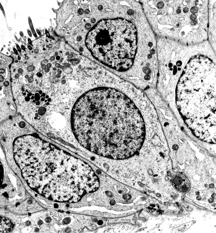 Fall sind die Cristae fast aller Mitochondrien verkümmert und ragen nur noch als kleine Stümpfe in das Innere des Zellorganells hinein (Abb. 23).