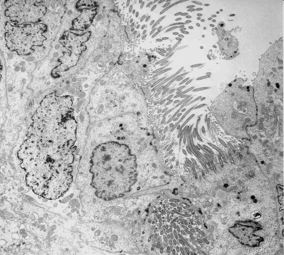 Abb. 5: 37-jährige Frau - Der Kinozilienbesatz ist im Tubenepithel sehr gut entwickelt. Die Mitochondrien sind in den Flimmerzellen vor allem supranukleär lokalisiert.