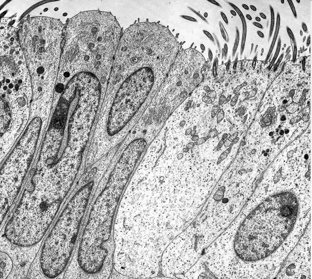 auf. Zwischen den Mikrovilli und im Tubenlumen konnten Sekrete lokalisiert werden, die durch den Vorgang der Exozytose aus der Zelle ausgeschleust werden.