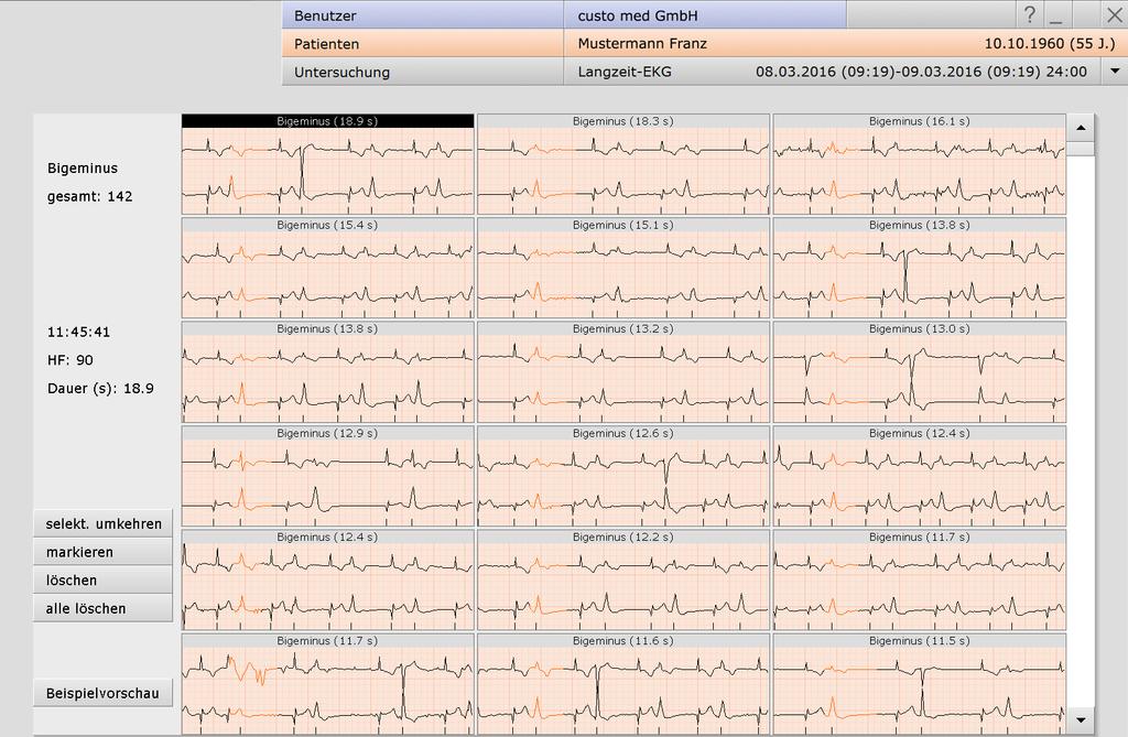 06.3.5 Beispiele, alle anzeigen (Schaltfläche alle anzeigen in der Beispielvorschau) Alle EKG-Beispiele eines Ereignisses Zusatzinformationen zum ausgewählten Beispiel Kehrt die aktuelle Auswahl um,